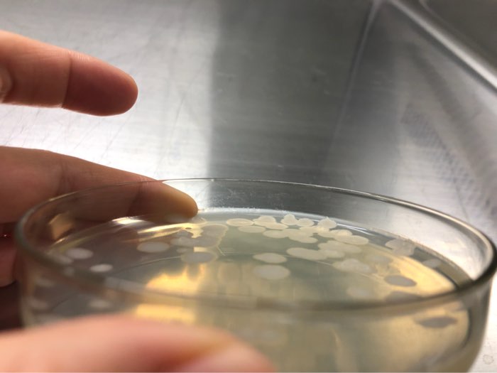 饮用水中大肠杆菌怎么检测？检测方法及国家标准解读